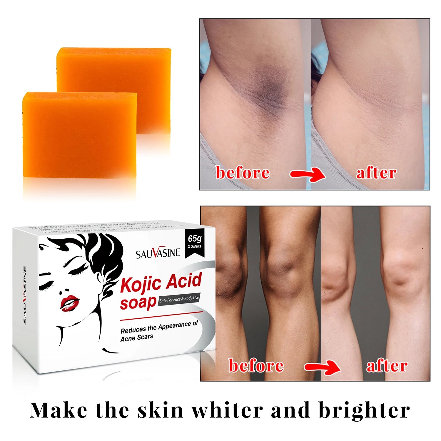 65G X2 Kojic Acid Soap Skin Lightening Even Skin Tone Facial Deep Cleaning Oil Control Moisturizing Skin Care Beauty Health